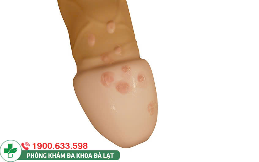 Hình ảnh minh họa